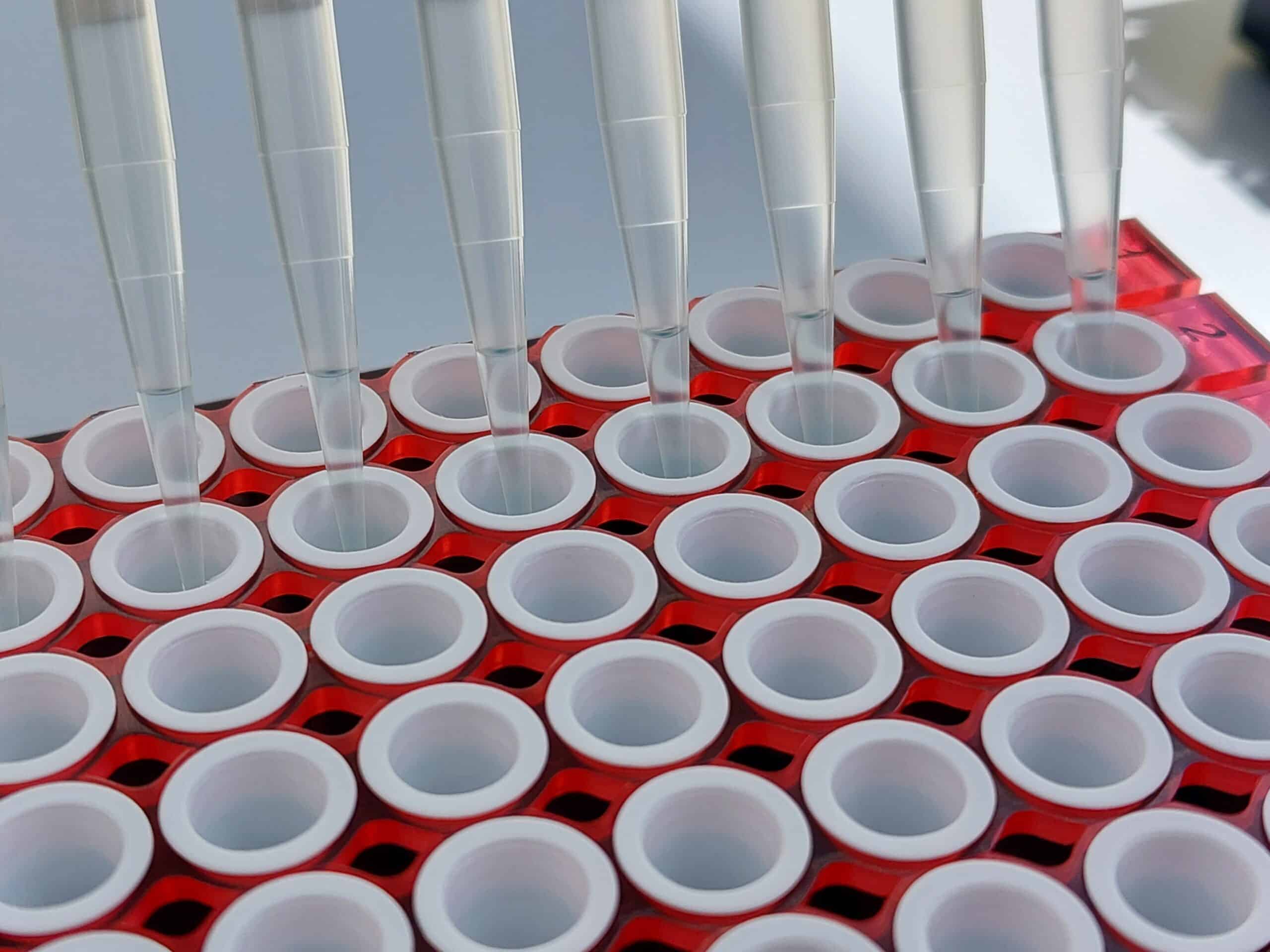 PCR-Untersuchung im Labor - Molekularbiologische Diagnostik